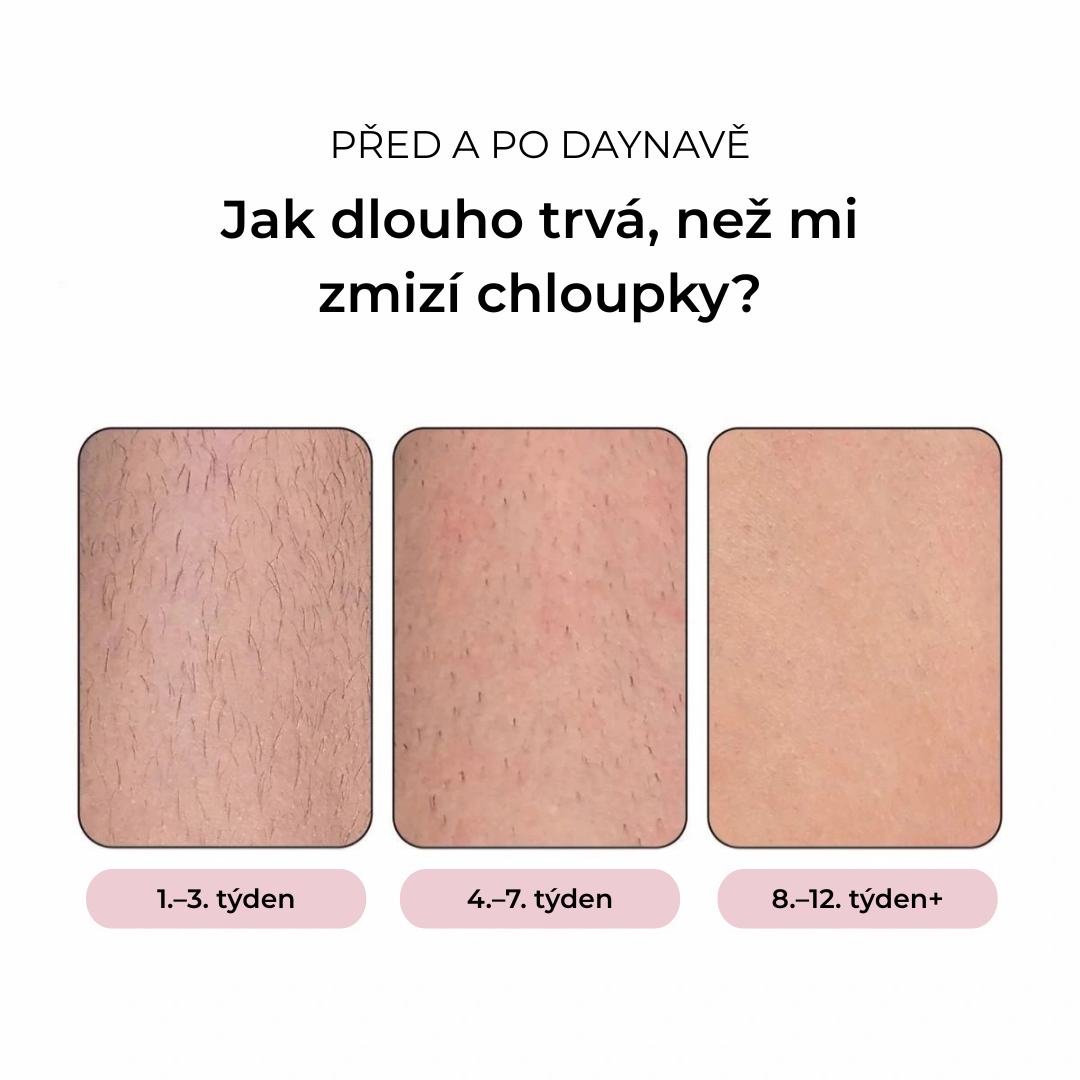 Daynava™ IPL Epilátor