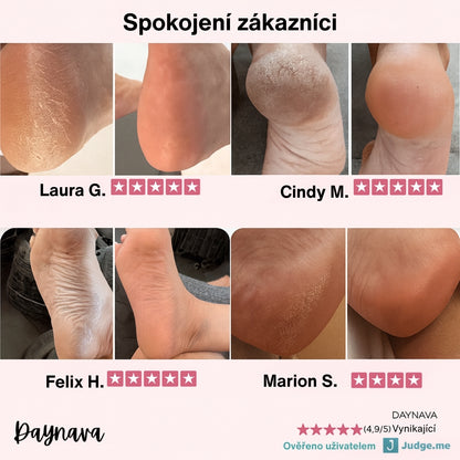 Elektrický pilník na chodidla Daynava