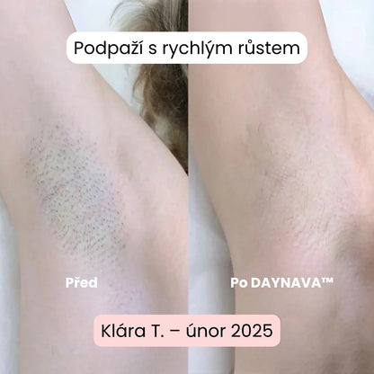 Daynava™ 5-v-1 Elektrický Holicí Strojek