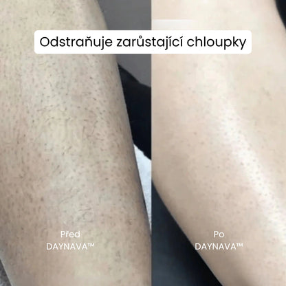 Daynava™ 5-v-1 Elektrický Holicí Strojek