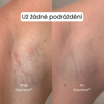 Daynava™ 5-v-1 Elektrický Holicí Strojek