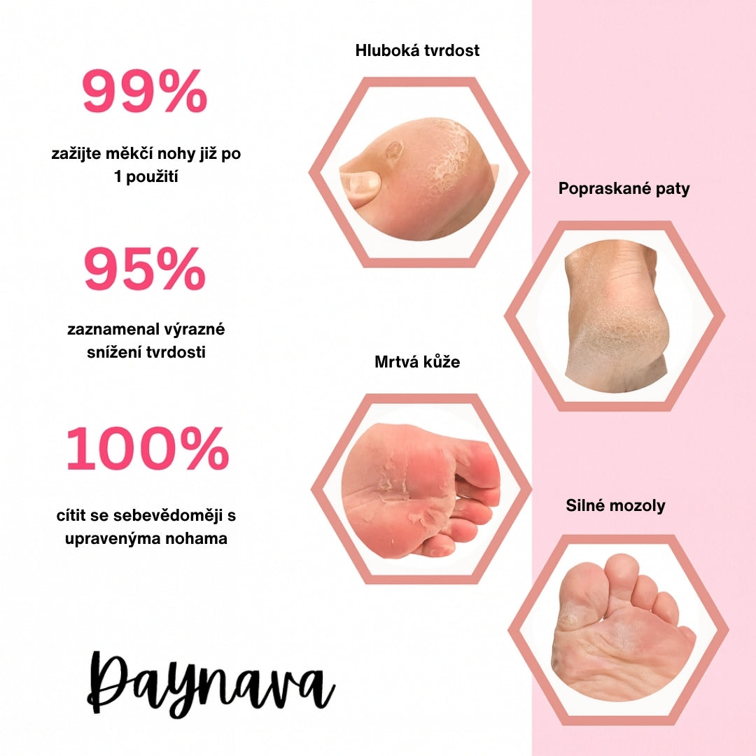 Elektrický pilník na chodidla Daynava