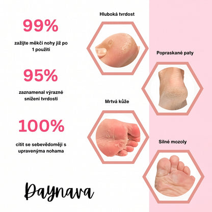 Elektrický pilník na chodidla Daynava