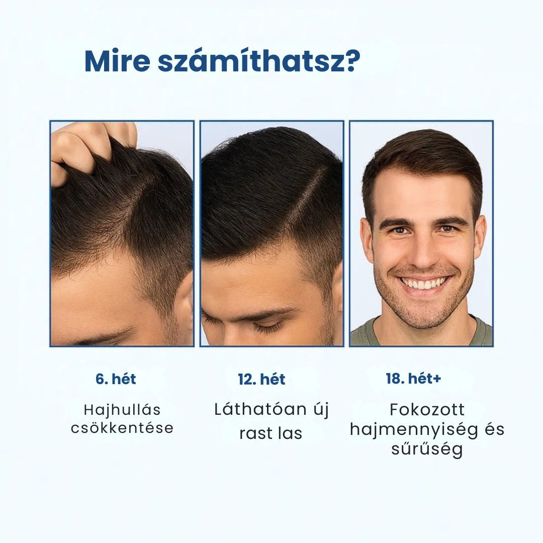 Daynava™ Roll-On a hajnövekedésért