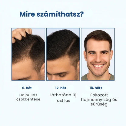 Daynava™ Roll-On a hajnövekedésért