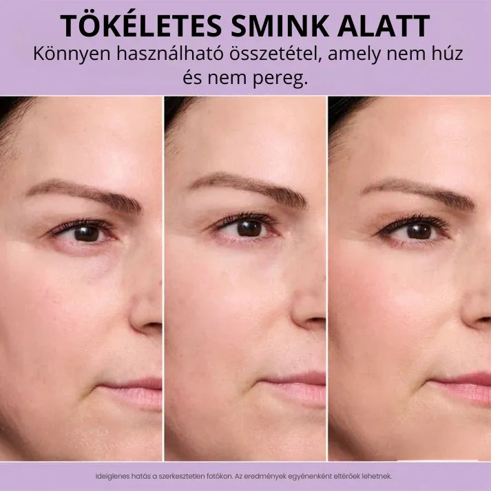 Daynava™ Azonnali Szemkörnyék-Lifting