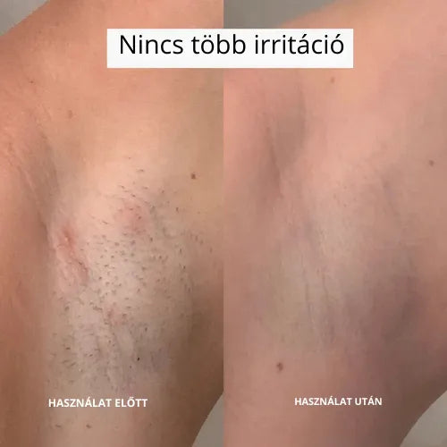 Daynava™ 5 az 1-ben Elektromos Borotva (HU)