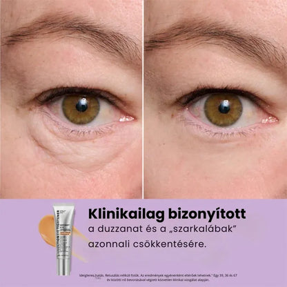 Daynava™ Azonnali Szemkörnyék-Lifting