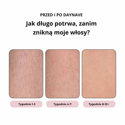 Daynava™ Depilator IPL