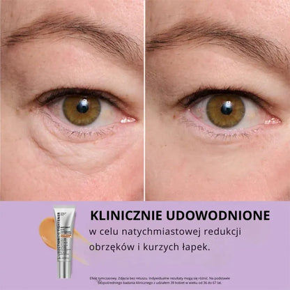 Daynava™ Natychmiastowy Lifting Pod Oczy